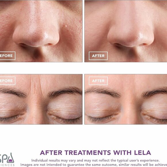 LELA - 4-in-1 Facial Spatula for Deep Cleansing, Pore Extraction, Serum Infusion - Picture 4 of 9